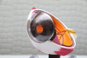 Lens Replacement Surgery